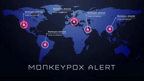 Animation of monkeypox text and world ma... | Stock Video | Pond5