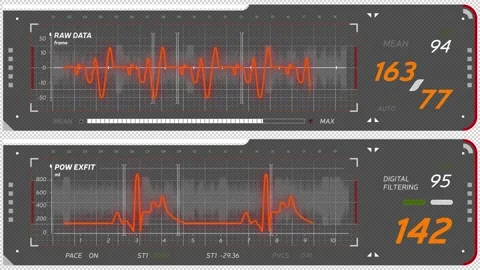 Animation of schematic diagram of human heart rhythm. ECG abstract HUD Stock Footage 144825503