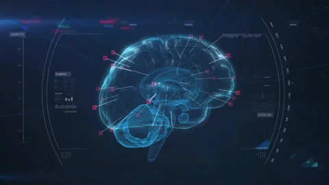 Animation of scope scanning with data processing and digital brain on black Stock Footage 309741987