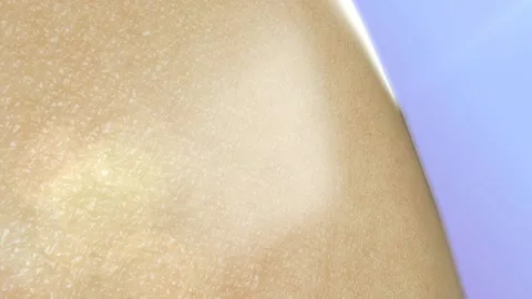 Animation Serum through the skin layer for repair Video stock 141505977