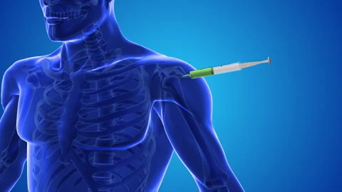 An animation shows stem cells being injected into a human shoulder Stock Footage 251551989