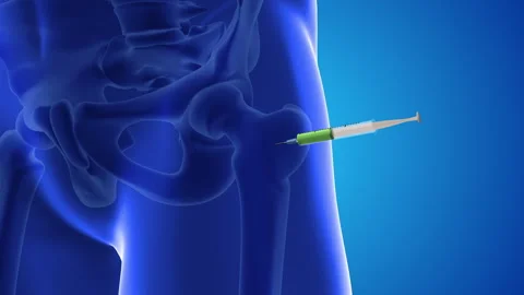 An animation shows stem cells being injected into a thighs Stock Footage 251857189