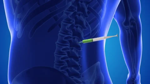 An animation shows stem cells being injected into a spine Stock Footage 251857251