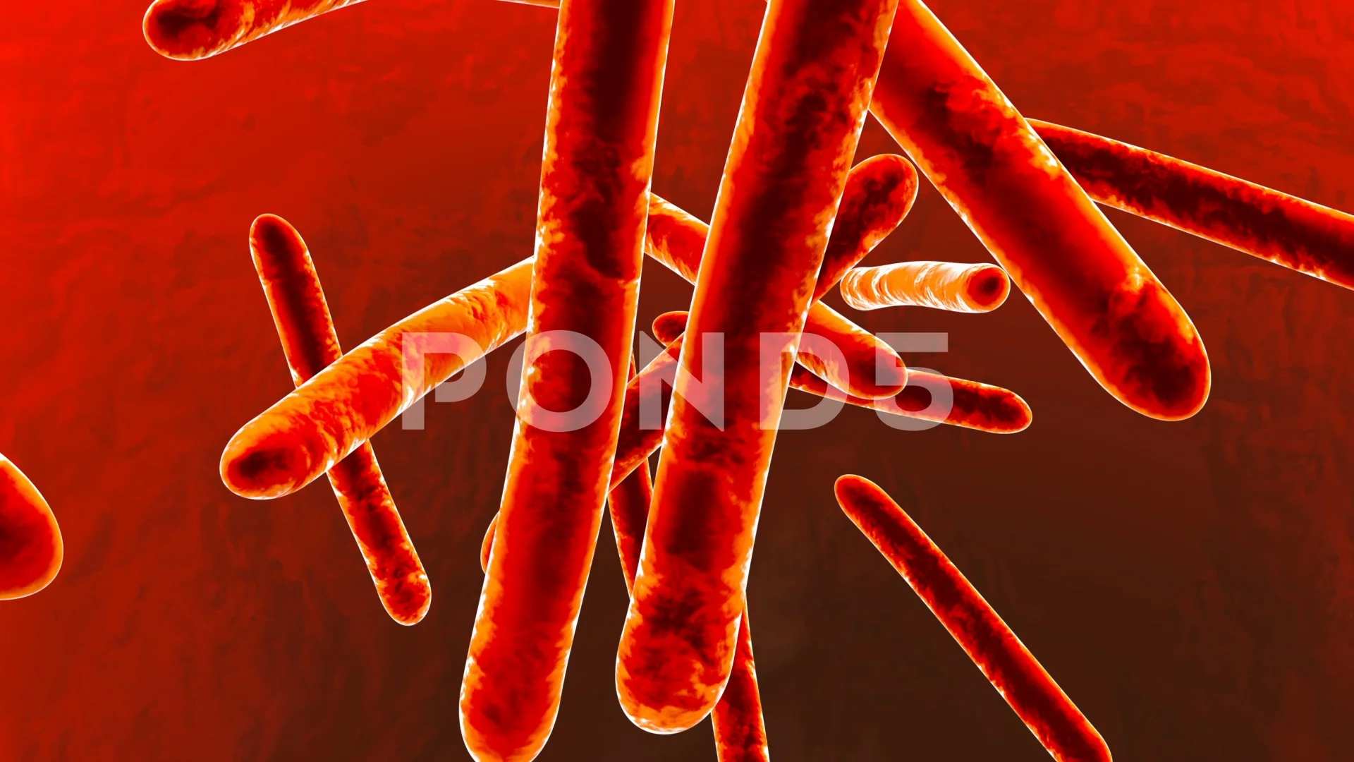 373 Types Tuberculosis Images, Stock Photos, 3D objects, & Vectors |  Shutterstock