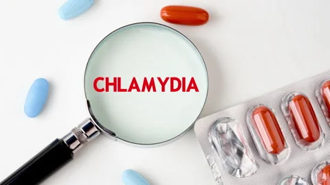 Animation of the word CHLAMYDIA through a magnifying glass Stock Footage 276527967