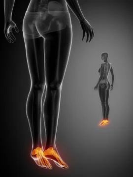 ANKLE black x--ray bone scan Stock Illustration