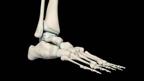 Ankle Fracture Stock Footage 121954417