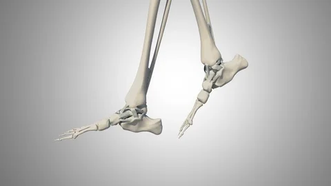 Ankle Ligament Tear Stock Footage 121617576