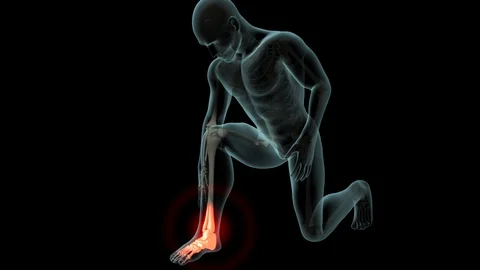 Ankle Pain Stock Footage 121969404