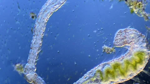 Annelid Aeolosoma under Microscope at 100x Magnification Stock Footage 346277321