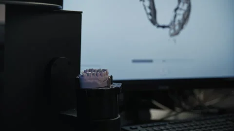 Anonymous Hand Places a Dental Impression on a 3D Scanner. Dental 3D Scanner Stockbeeldmateriaal 336626863