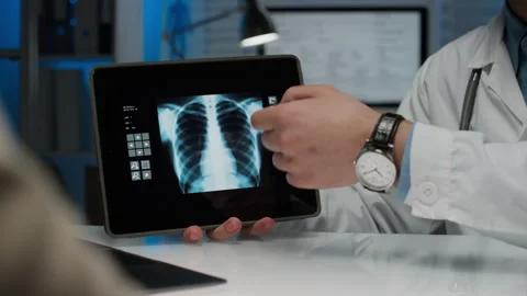 Anonymous Lung Specialist Interpreting Chest X-Ray on Tablet to Patient Видео 280045736