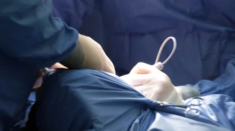 Anonymous Modern Surgery CU Hands Stock Footage 47608395