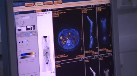 Anonymous Pet CT Scanner Patient Monitor Results Stock Footage 47720288