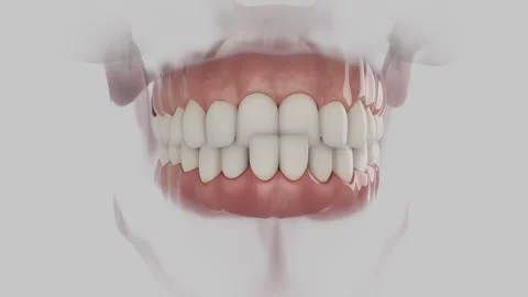 Anterior Cross Bite 動画素材 317145022