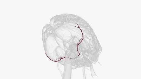 Anterior Inferior Cerebellar Arteries 3d 