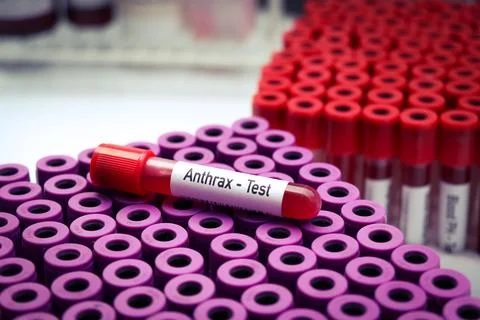 Anthrax test to look for abnormalities from blood Stockfoto's