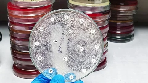 Antibiotic susceptibility testing of Candida spp. Video stock 337722983