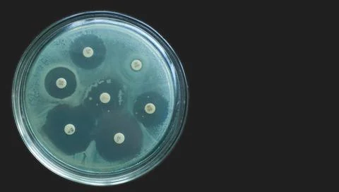 Antimicrobial susceptibility test by diffusion kirby bauer on dark background 스톡 사진