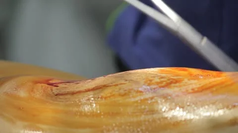 Antiseptic Video stock 11879061