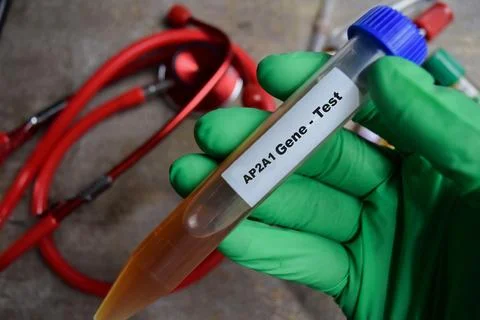 AP2A1 Gene - Test with blood sample in green gloved hands. Foto stock