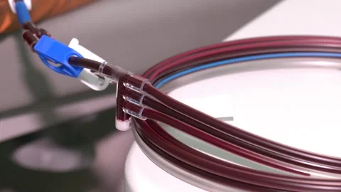 Apheresis machine to extract plasma and platelet from whole blood Stock Footage 182081924