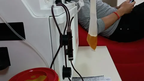 Apheresis machine to extract plasma and platelet from whole blood. Donation bloo Stock Footage 216907788