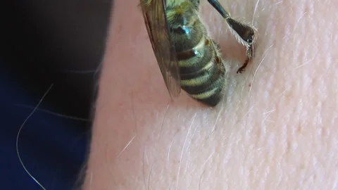 Apitherapy. With the help of tweezers, the bee is placed on the skin of a person Stock-Footage 253865439