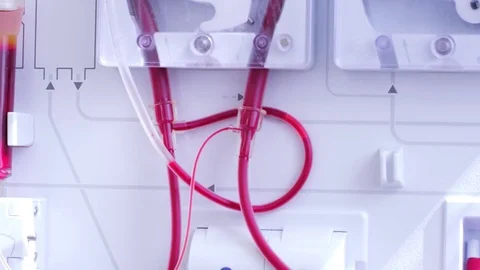 An apparatus for pumping blood Stock Footage 78733423