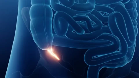 Appendicitis Stock Footage 191966199