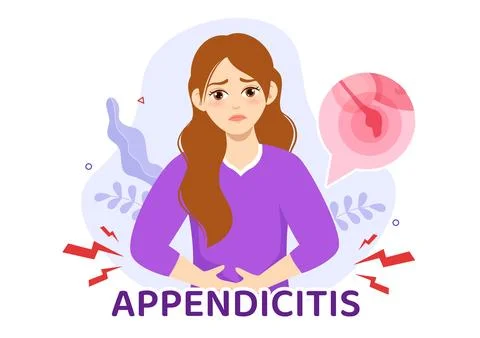 Appendicitis Illustration with Inflammation of the Appendix and Stomach Tre.. 스톡 일러스트