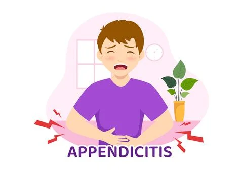 Appendicitis Illustration with Inflammation of the Appendix and Stomach Tre.. Stock Illustration