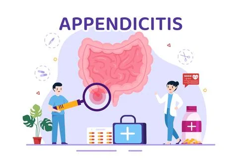 Appendicitis Illustration with Inflammation of the Appendix and Stomach Tre.. Stock Illustration