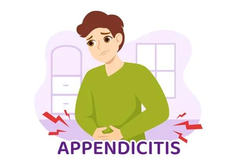Appendicitis Illustration with Inflammation of the Appendix and Stomach Tre.. Stock Illustration