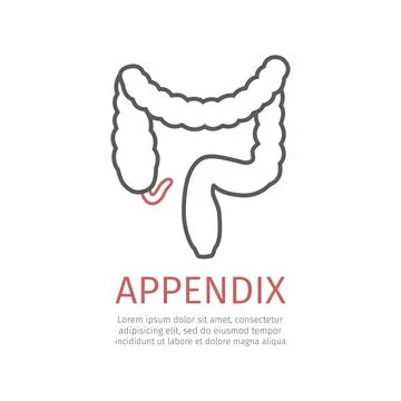 Appendicitis. Inflammation of the appendix. Stock Illustration