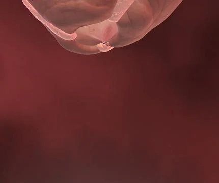 Appendicitis is a painful swelling of the appendix. Stock Illustration