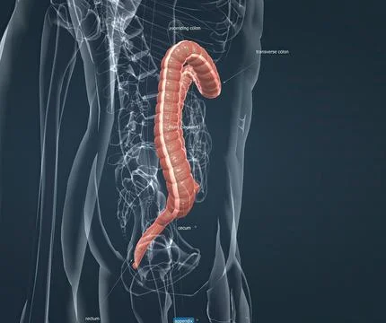 Appendicitis is a painful swelling of the appendix. 스톡 일러스트