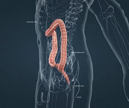 Appendicitis is a painful swelling of the appendix. 스톡 일러스트