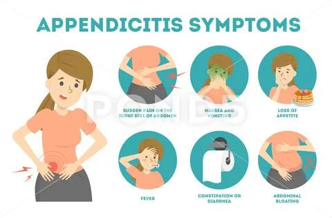 Appendicitis symptoms infographic. Abdominal pain, diarrhea and vomiting Stock Illustration