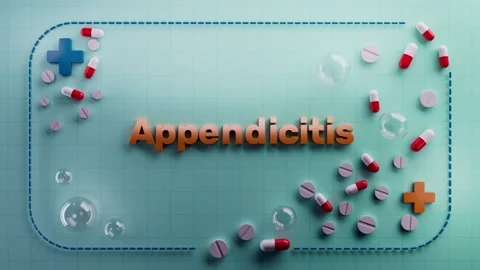 Appendicitis text animation on 3D medical background Stock Footage 314374100