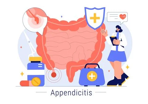 Appendicitis Vector Illustration Featuring Inflammation of the Appendix and.. Stock Illustration