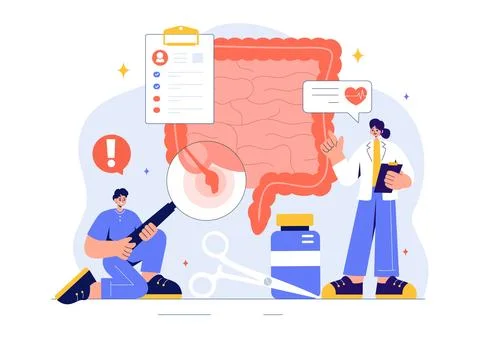 Appendicitis Vector Illustration Featuring Inflammation of the Appendix and.. Stock Illustration