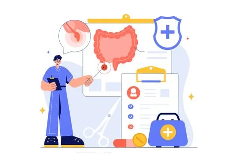 Appendicitis Vector Illustration Featuring Inflammation of the Appendix and.. Stock Illustration