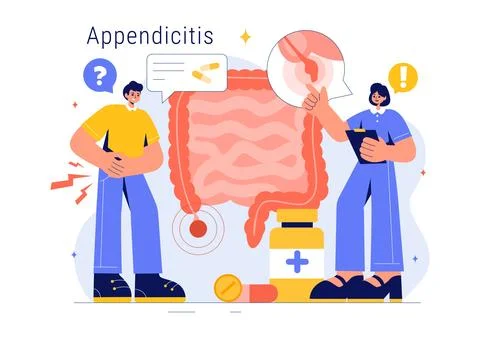 Appendicitis Vector Illustration Featuring Inflammation of the Appendix and.. Stock Illustration