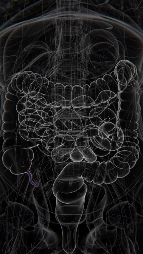 Appendicitis Vertical Video | appendix Animation Concept Video | appendix Stock Footage 279659604