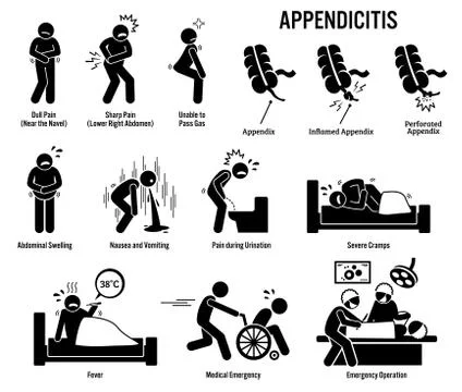 Appendix and Appendicitis Icons Illustrazione stock