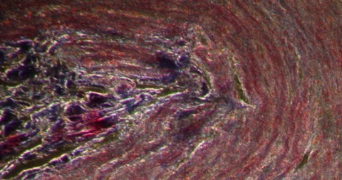 Appendix inflamation in Darkfield Stock Footage 147491511