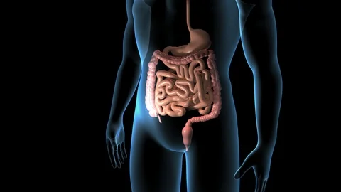 Appendix Inflammation Stock-Footage 122195514