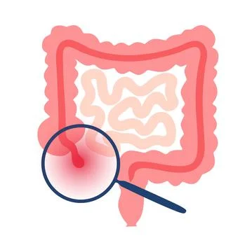 Appendix pain concept 스톡 일러스트