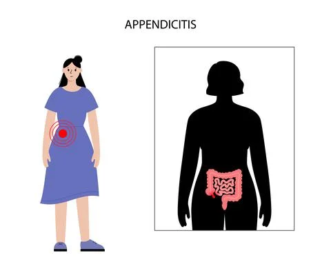 Appendix pain concept Stock Illustration